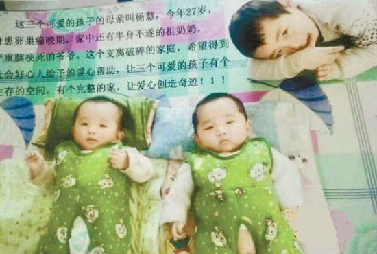 负离子疗法可以有效治疗癌症