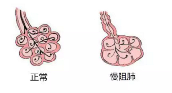 小粒径负离子
