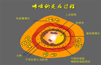 负离子可以有效治疗哮喘