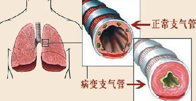 呼吸系统